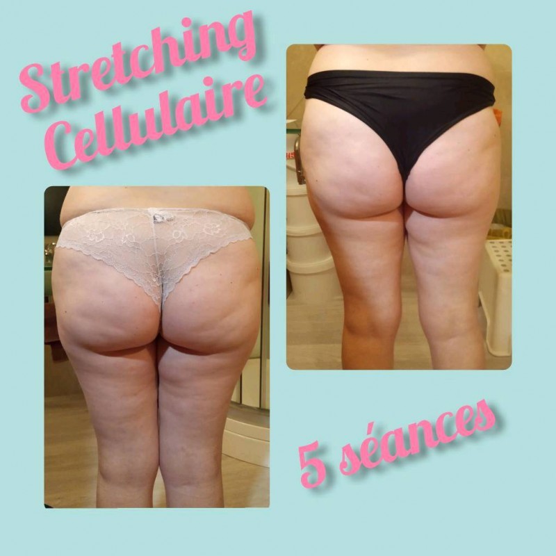 soin minceur forfait raffermissant, sans douleur à petit prix sur Martigues