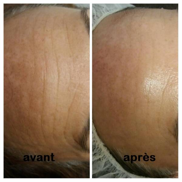 magnifique résultat, soin nourrissant, hydratant, anti-ride, regonfler les rides