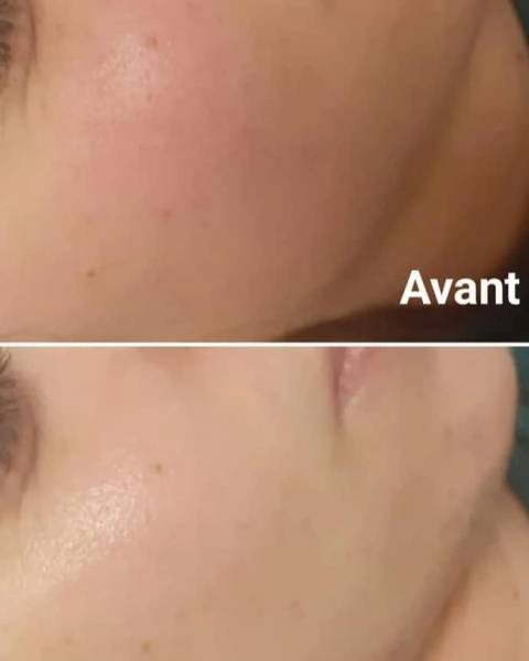 soin du visage anti-rougeurs, peaux lumineuse, rougeurs apaisées, 