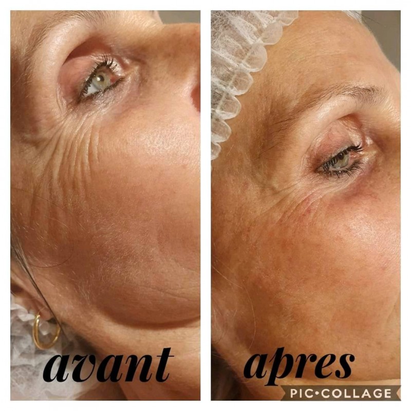 regarde moins marqué, anti-cernes, anti-rides, soin spécial autour des yeux, hydratation regard