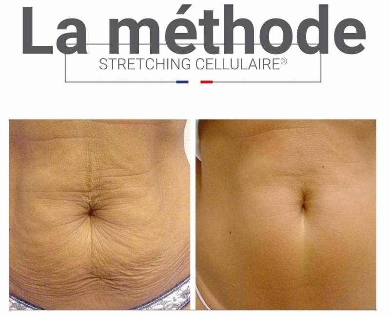 résultat séance fermeté, institut de beauté, raffermir, martigues, petit prix