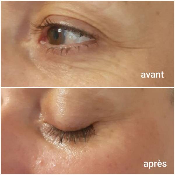 cabine de soin spécialiste des soins et problème de peau acné, boutons, rougeurs