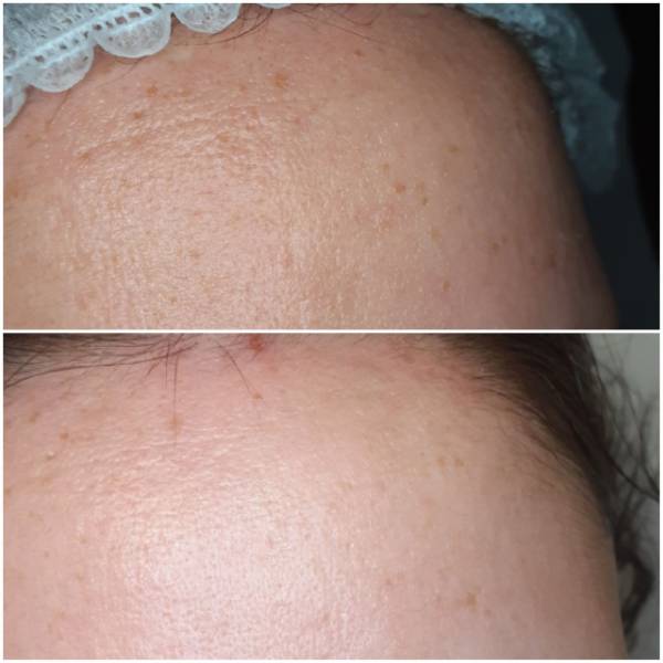 keraothérapeute spécialiste des soins visage et corps, produits dr reiner janka