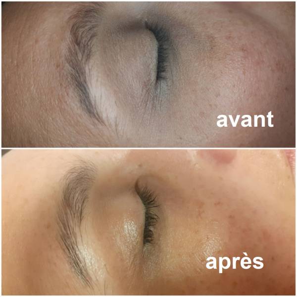 soin du visage hydratant, peau terne, contour des yeux, cernes pigmentaires, anti-ride